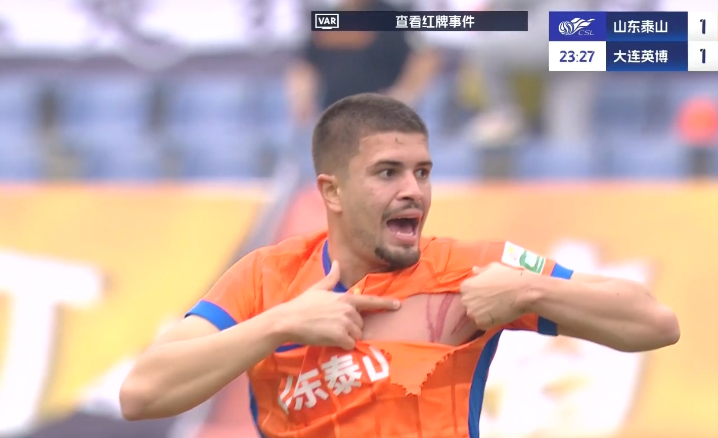 大連少打一人！卡蘭加蹬踏直紅，卡扎爾球衣被蹬爛+胸部三道血痕