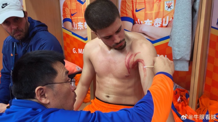 硬漢！記者曬卡扎爾受傷照，肩胛及上臂處多條血痕