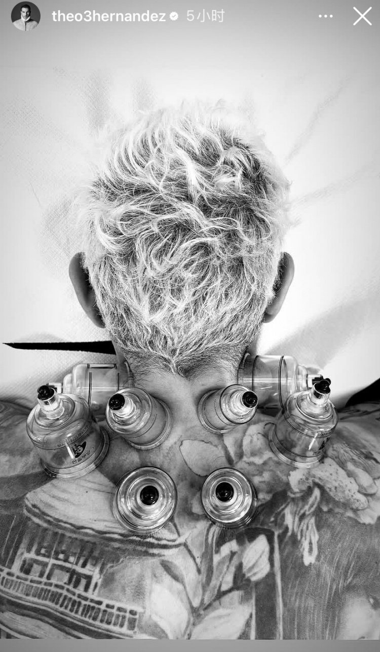 神秘東方力量加持？特奧社媒曬照，自己正在接受拔罐治療